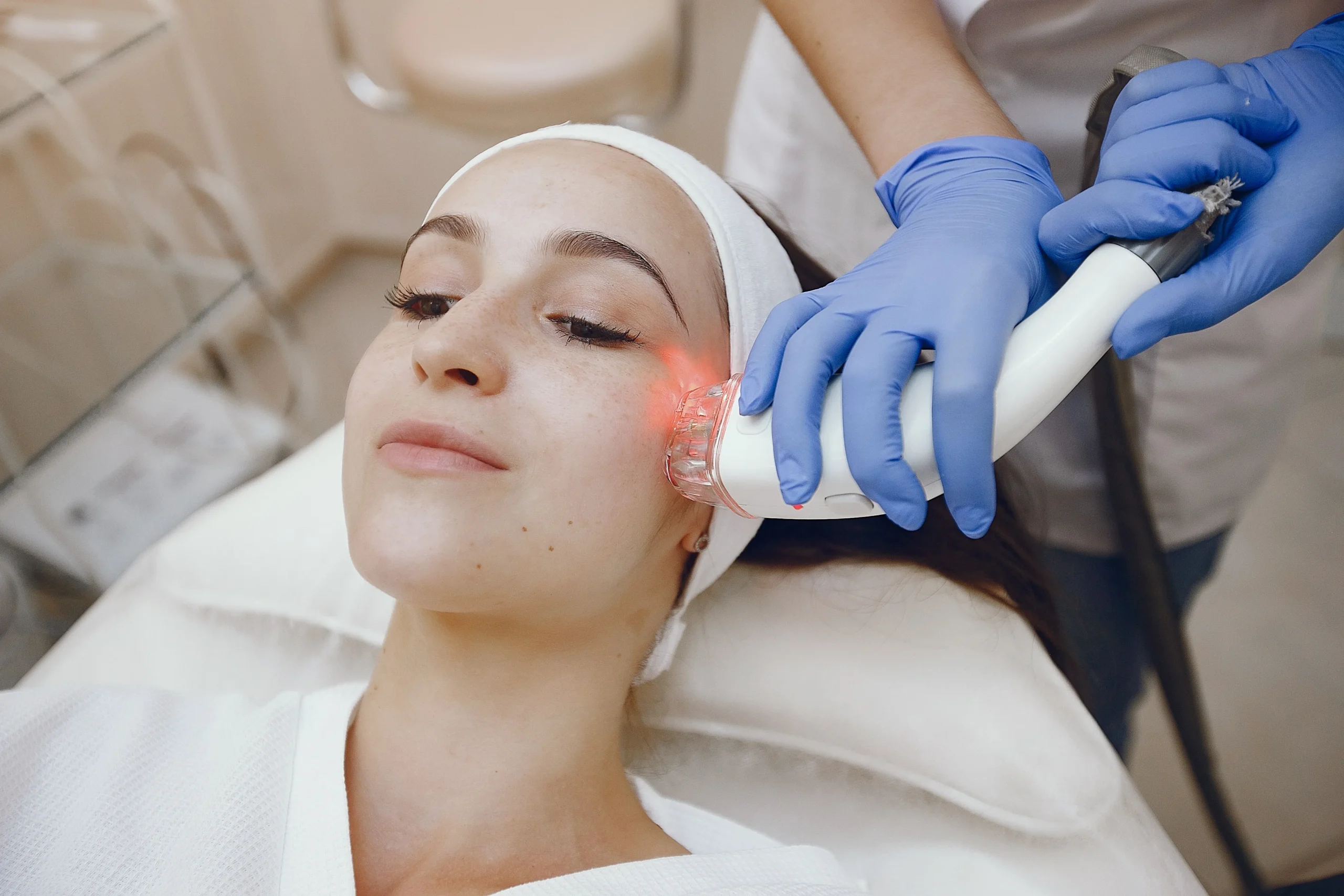 laser treatment for acne